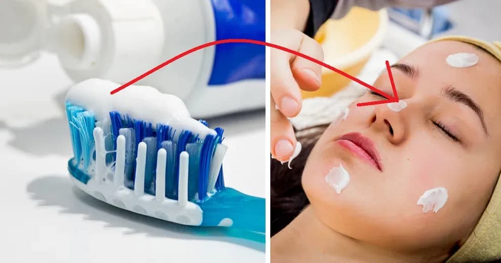 Jak długo trzymać pastę do zębów na pryszcze, aby uniknąć podrażnień?