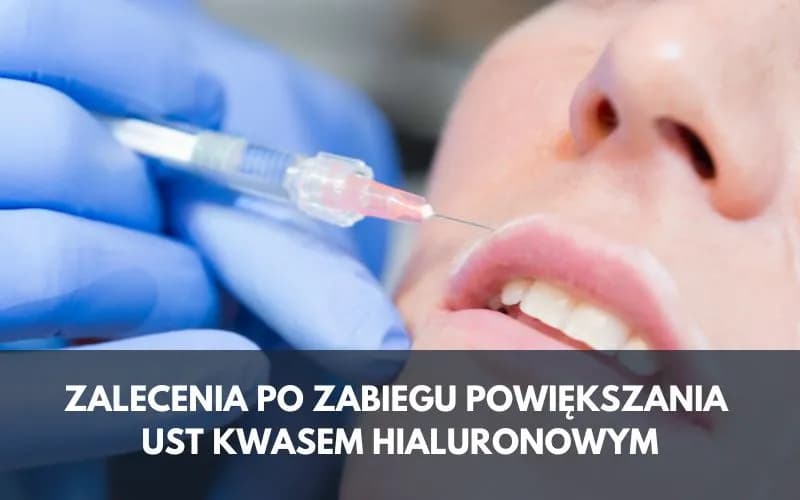 Czego nie wolno robić po wstrzyknięciu kwasu hialuronowego, aby uniknąć problemów?