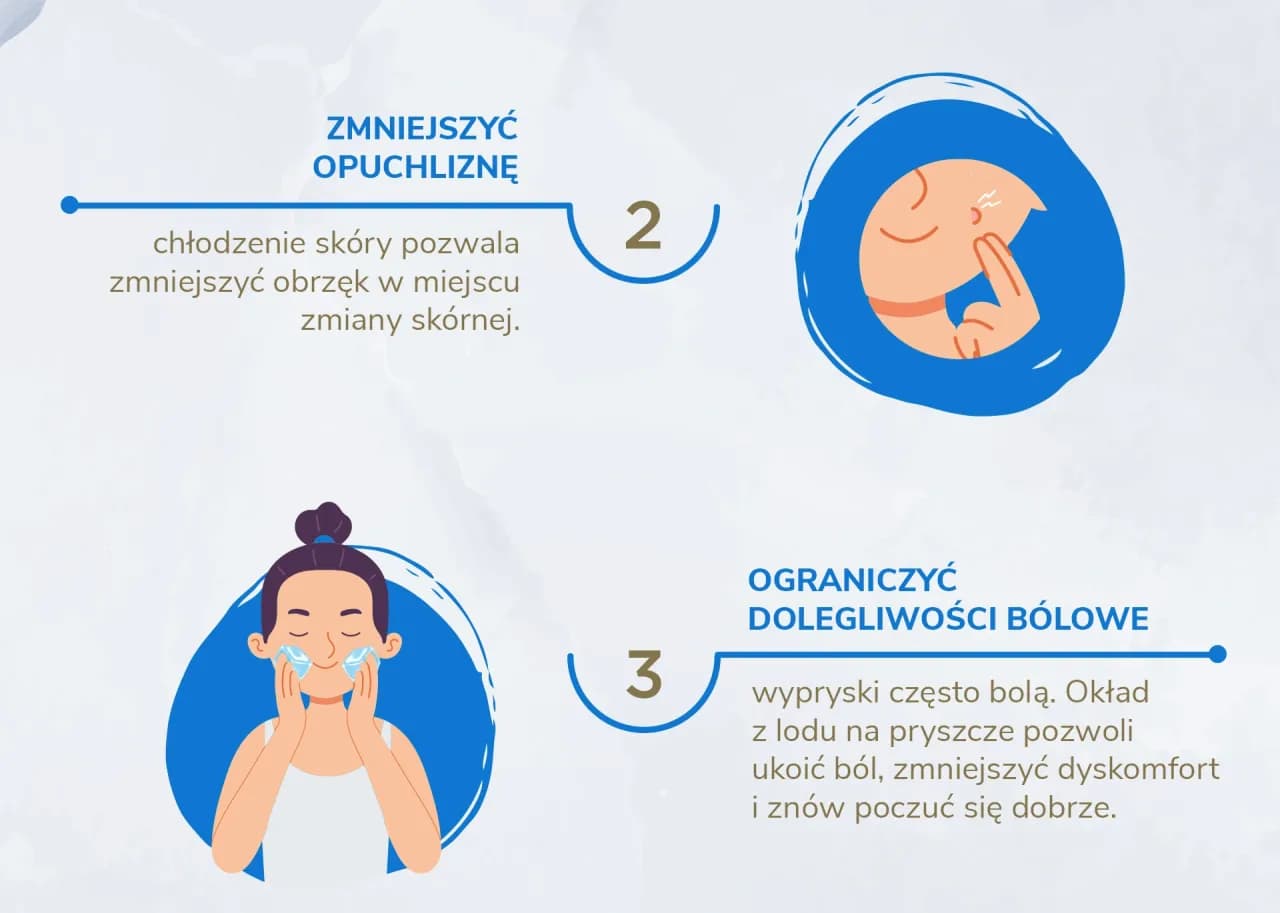 Czy lód pomaga na pryszcze? Poznaj skuteczne metody łagodzenia trądziku