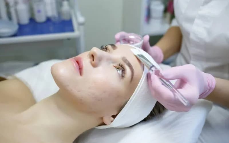 Jak wyleczyć pryszcza skutecznie i szybko – sprawdzone metody na trądzik