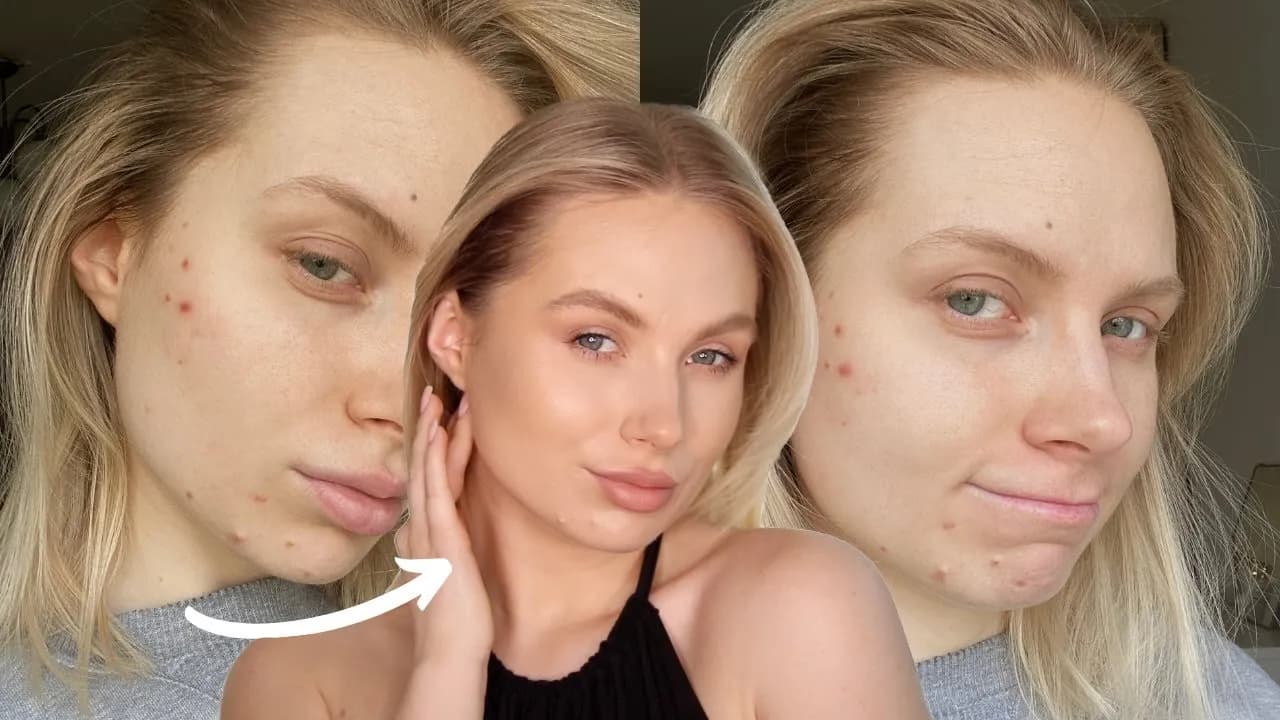 Jak dobrze zakryć pryszcza i uniknąć widocznych niedoskonałości