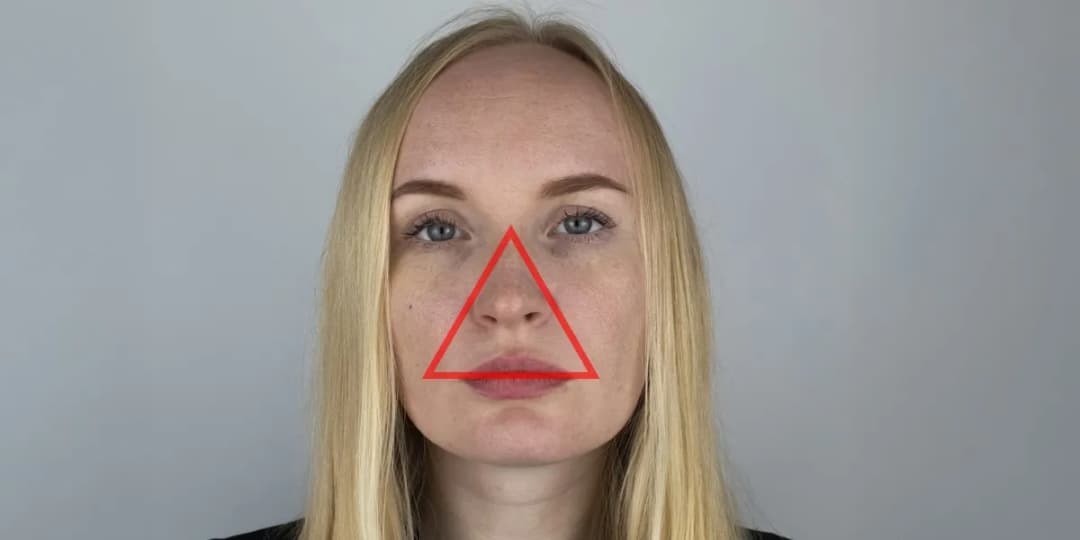 Gdzie nie wyciskać pryszczy? Unikaj tych niebezpiecznych miejsc