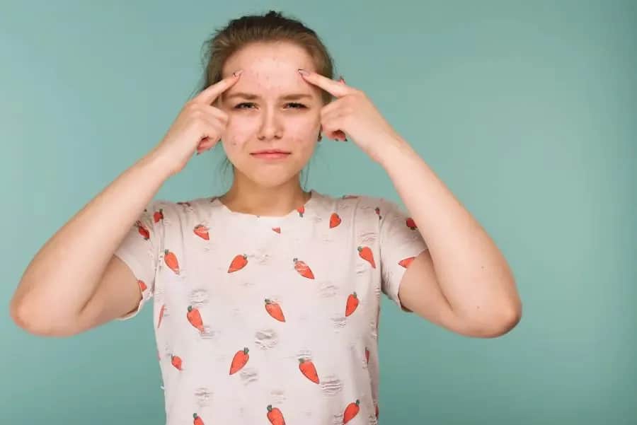 Co powoduje pryszcze? Odkryj zaskakujące przyczyny trądziku