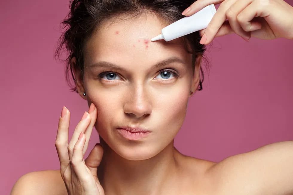 Jak zmniejszyć zaczerwienienie pryszcza - skuteczne metody na szybko