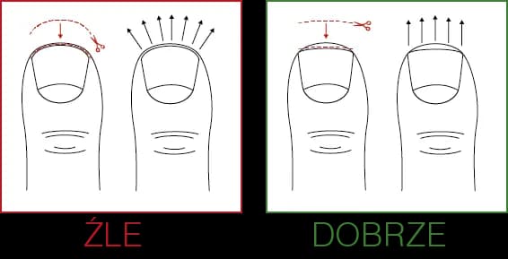 Czym obcinać paznokcie, aby uniknąć wrastania i bólu?