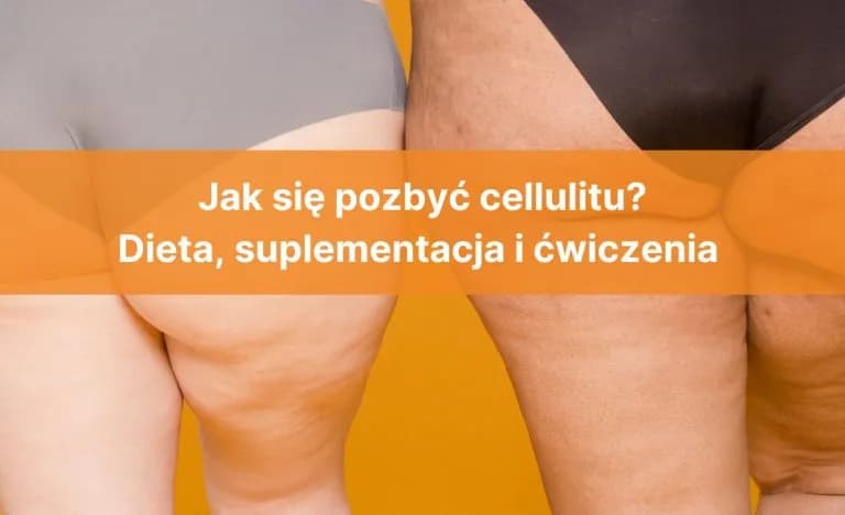 Co to jest cellulit i jak go skutecznie zwalczyć? Oto prawda