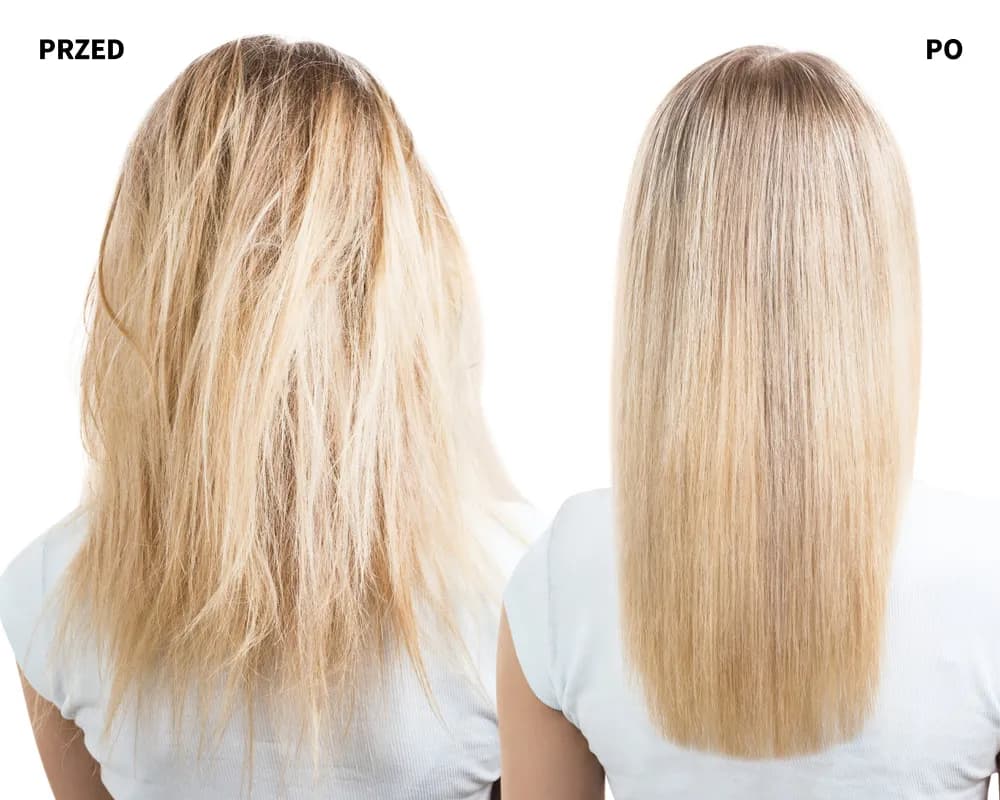 Botoks czy keratyna - który zabieg lepiej poprawi stan Twoich włosów?