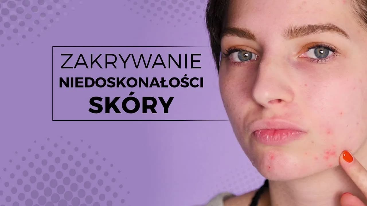 Jak ukryć pryszcze bez makijażu? Skuteczne metody i porady