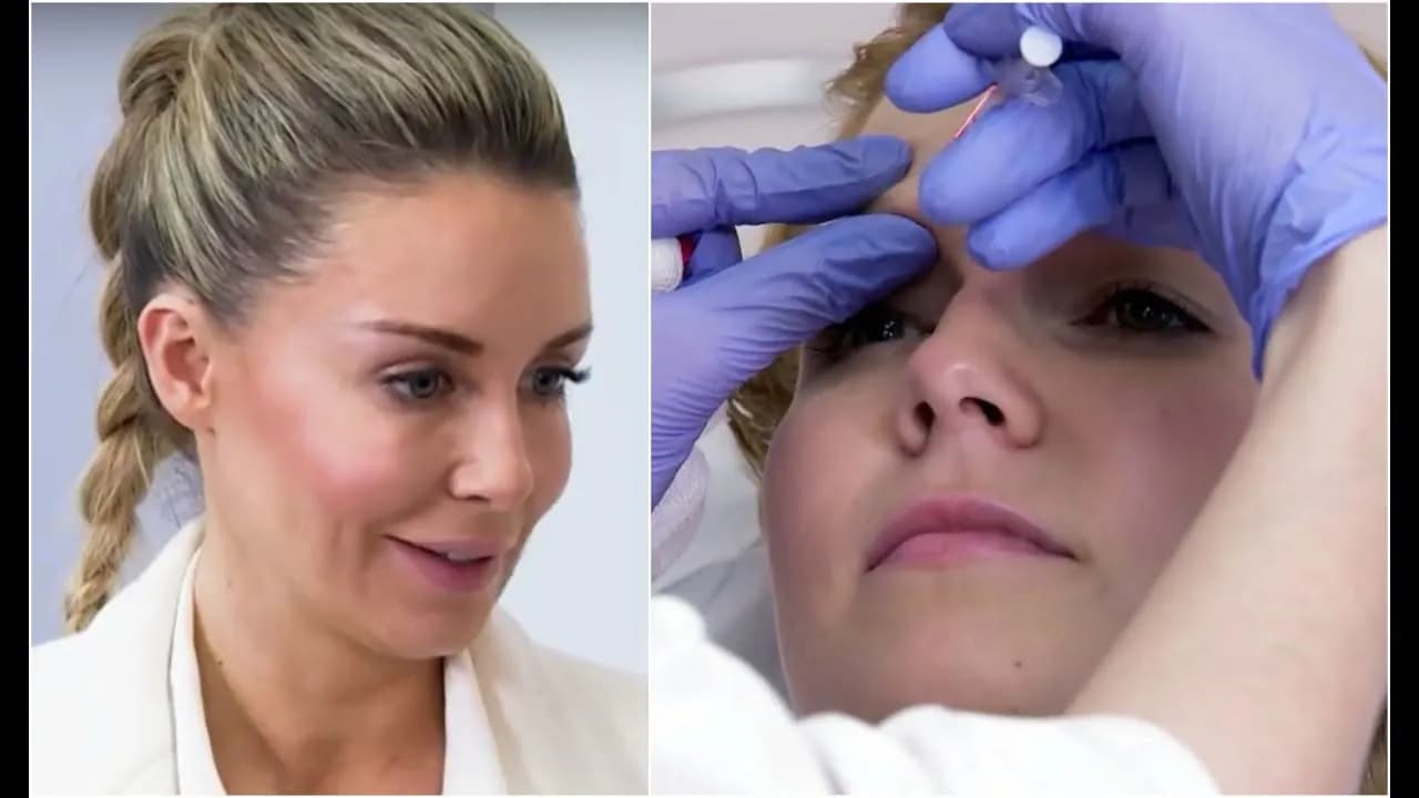 Gdzie kupić zastrzyki z botoksu? Sprawdź, co musisz wiedzieć