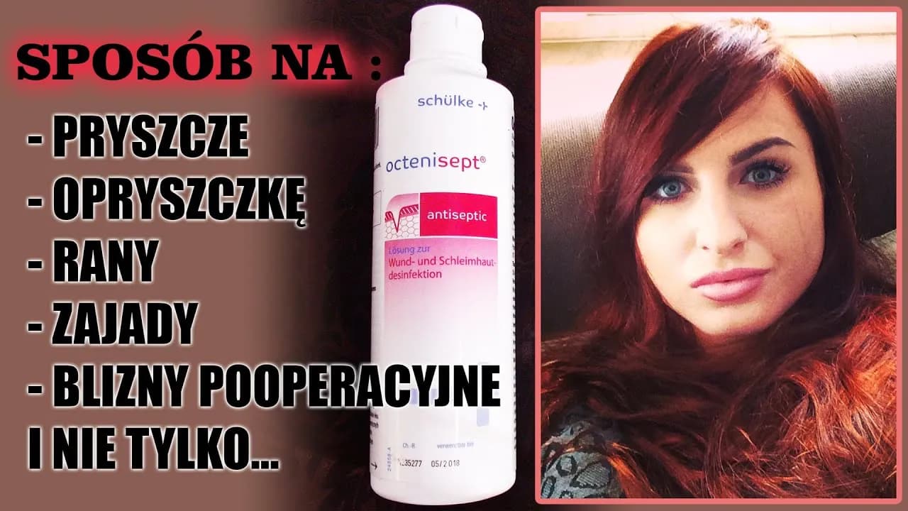 Co na wycisniete pryszcze: skuteczne metody na podrażnienia i blizny