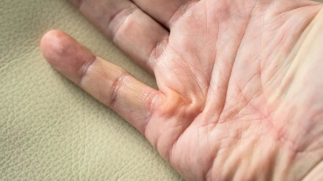 Do jakiego lekarza z paznokciami udać się, by uniknąć bólu?