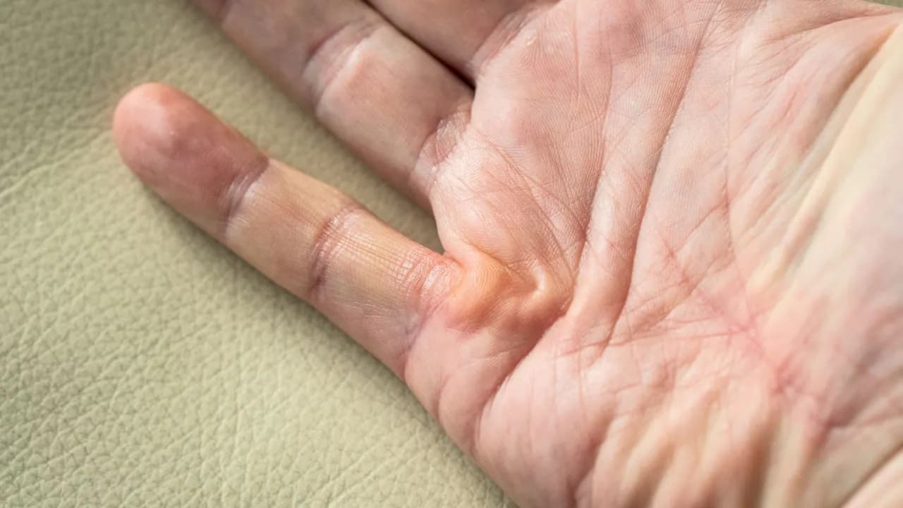 Do jakiego lekarza z paznokciami udać się, by uniknąć bólu?