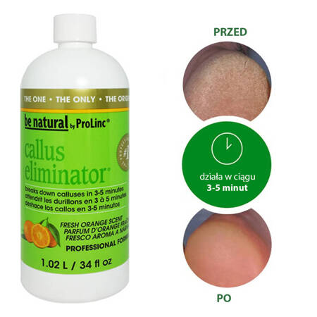 Płyn do usuwania zrogowaciałej skóry Orange PROLINC Callus Eliminator 532ml